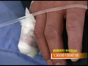 骑摩托被掉落光缆勒断手指 车主觉得很冤    
