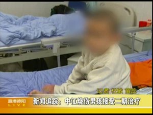 新闻追踪：中江烧伤男孩接受二期治疗